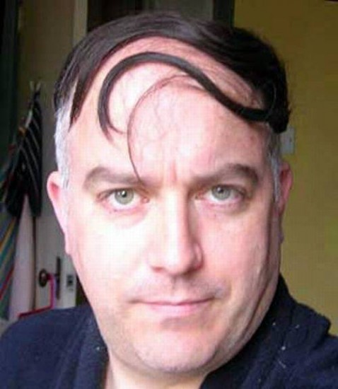 bald16.jpg