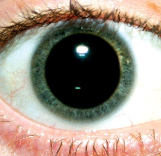 dilated_pupil.jpg