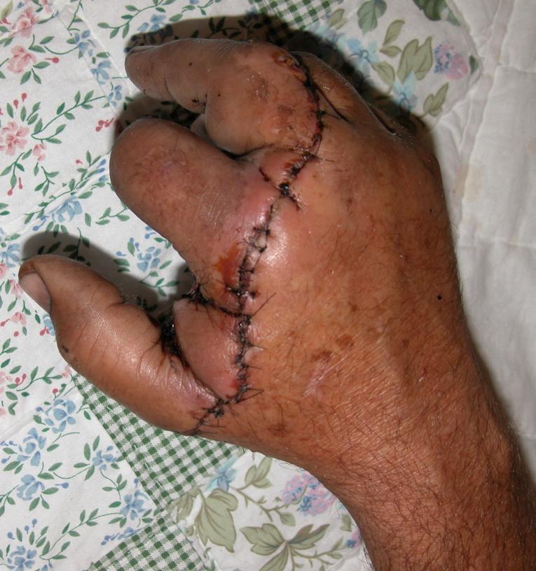 hand from top.jpg