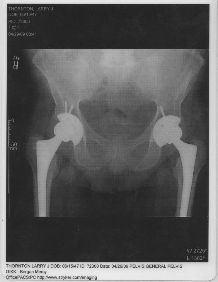 hips.jpg