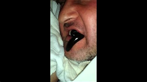 leech.jpg