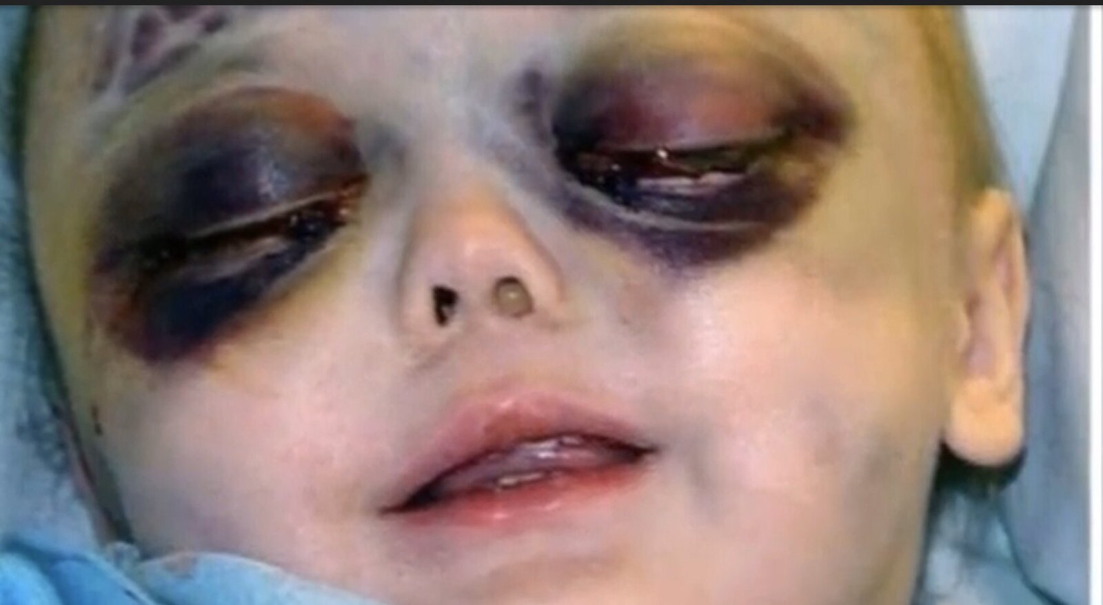 panda-eyes1-3588737117.jpg