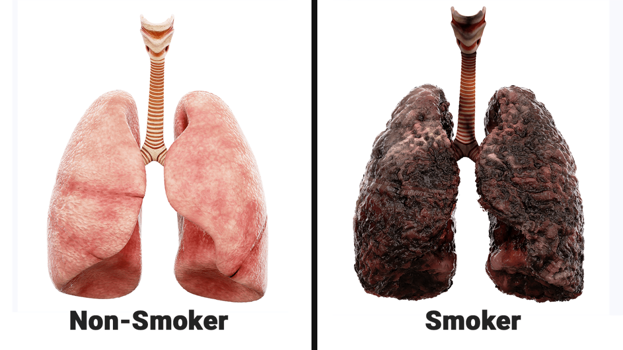 Scientists-Explain-What-Smoking-Every-Day-Does-To-Your-Lungs.png