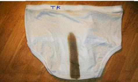 skid marks.jpg