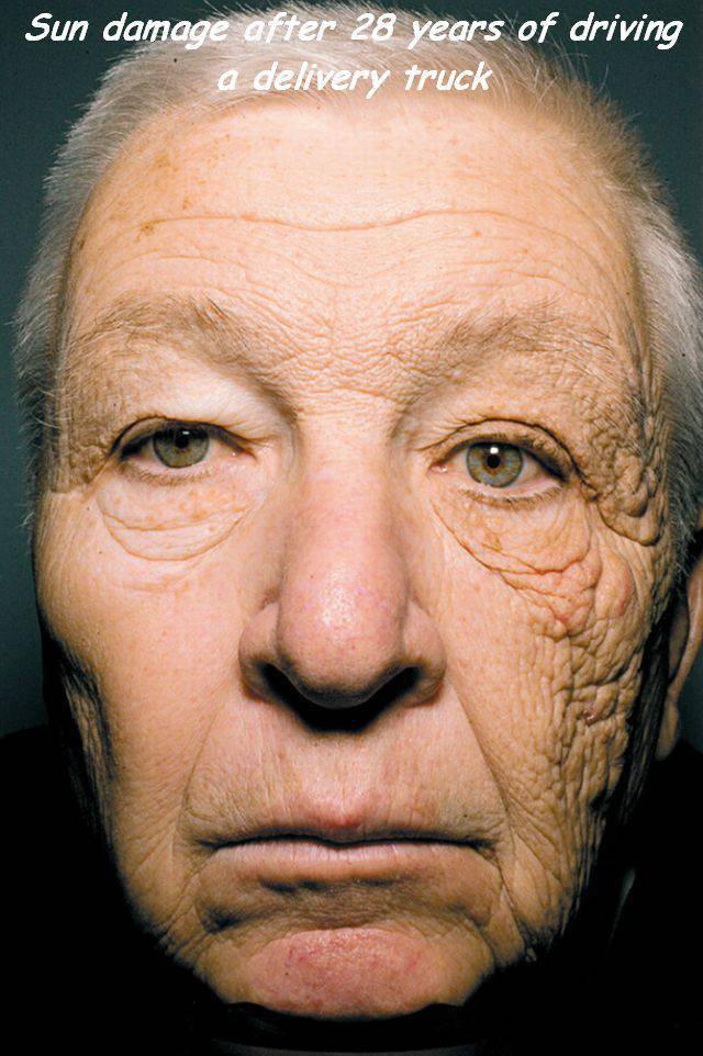 sun damage.jpg