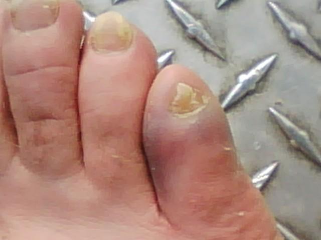 the toe.jpg