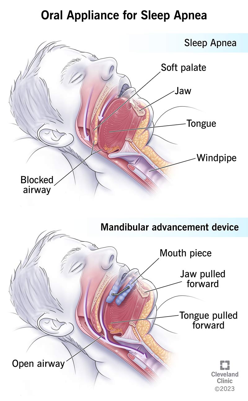 my.clevelandclinic.org