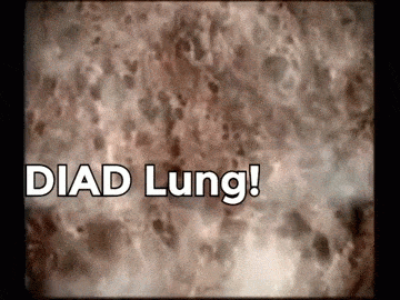 vMznD4.gif