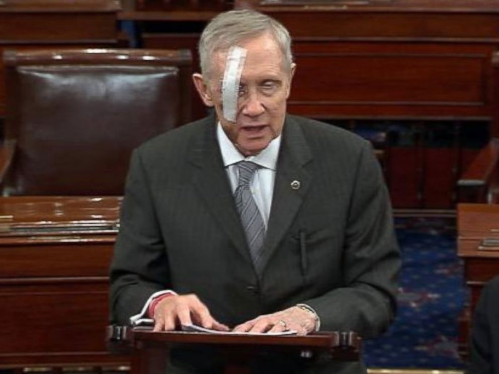 ht_harry_reid_eye_bandage_jc_150224_4x3_992.jpg
