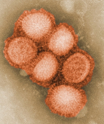 h1n1.jpg