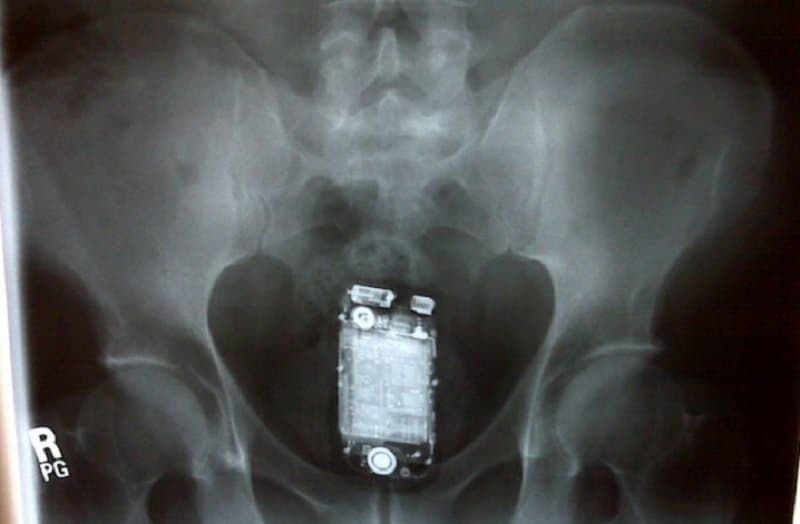 10-incredible-x-rays-that-you-wont-believe-are-real.jpg