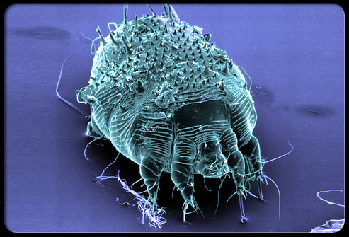 scabies_s1a_mite.jpg