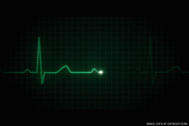 ekg-o.gif