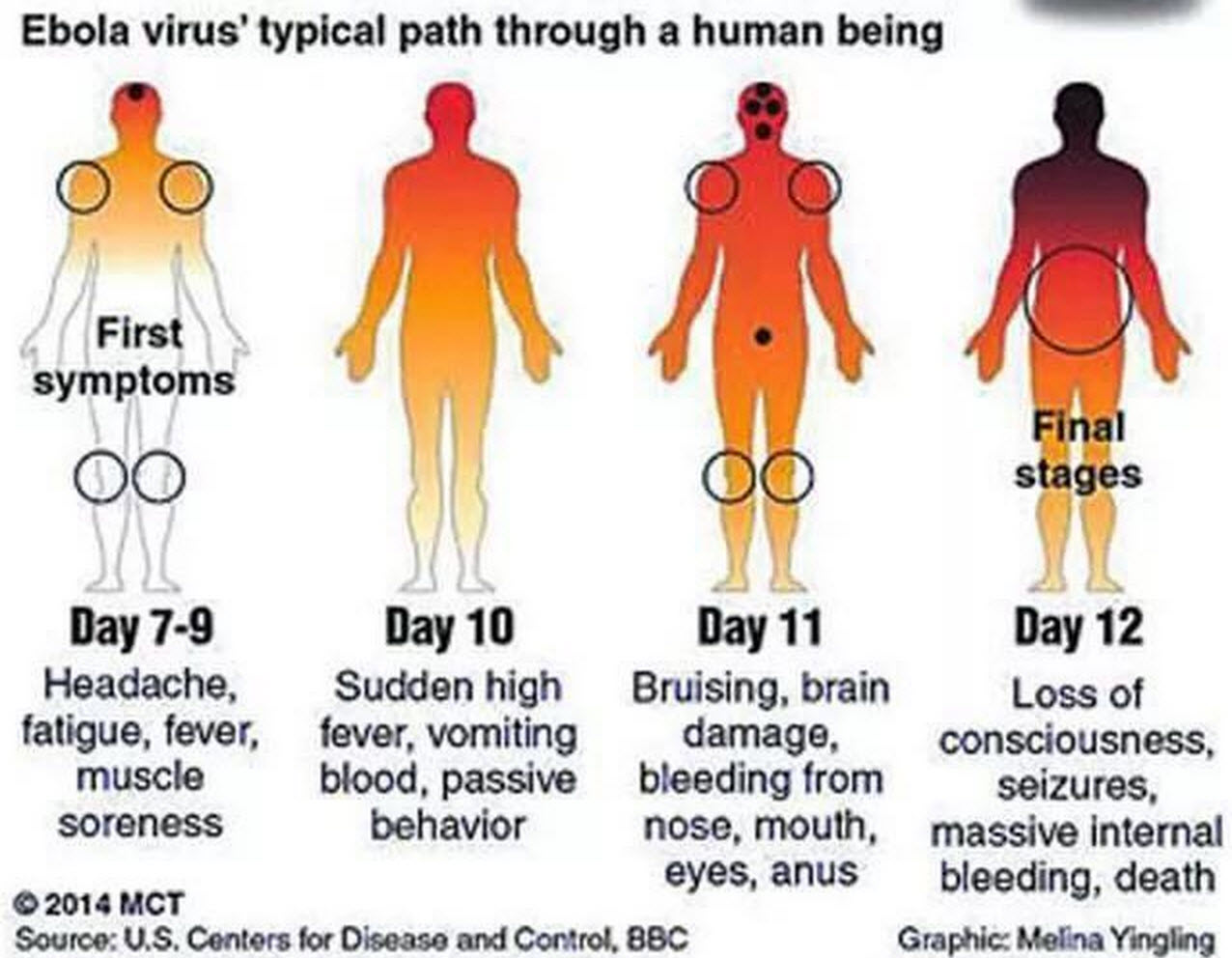 Third-American-Ebola-Patient.jpg